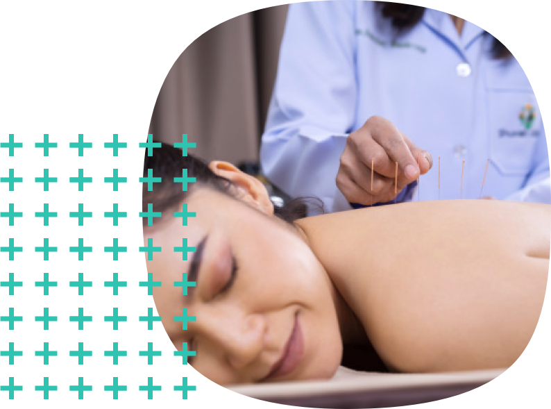 Acupuncture Image